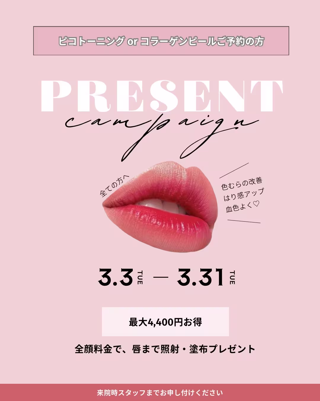 2026-march-campaign-1