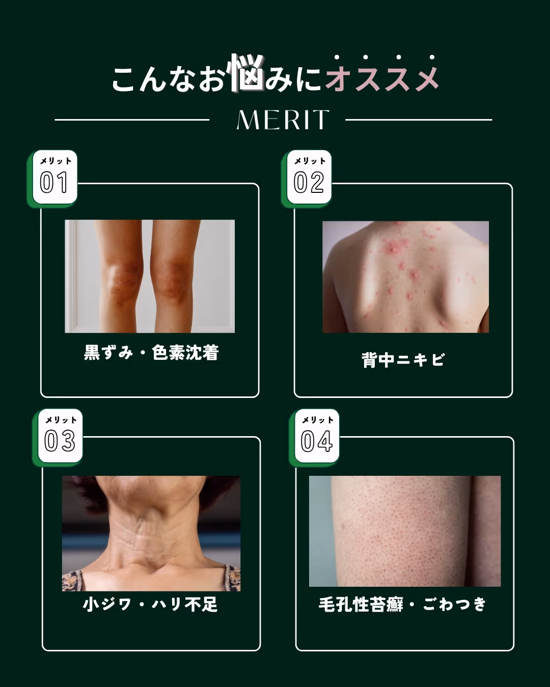 攻めすぎないボディピーリング｜真皮へ働きかけてハリ感アップ