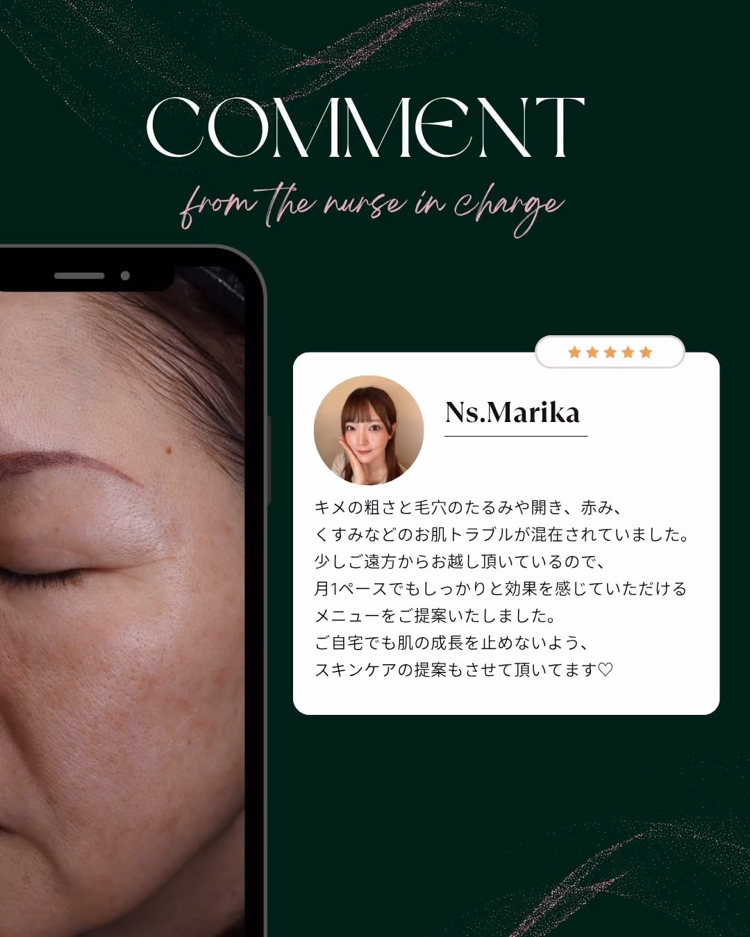 幹細胞水光注射 vs 通常水光注射の違い