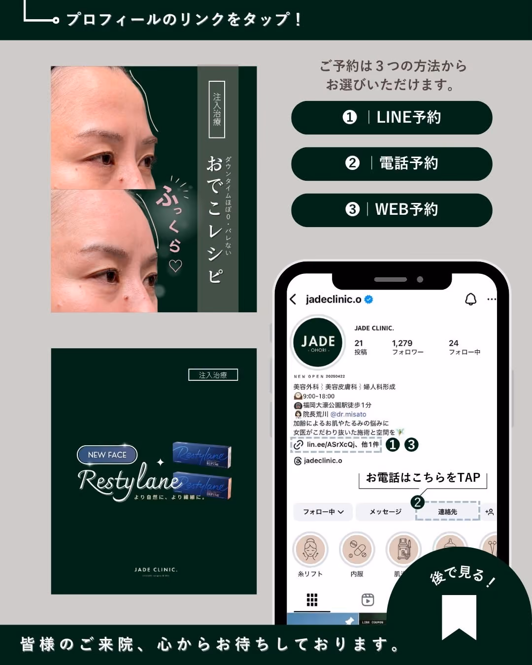 症例別ヒアルロン酸注入 No.12|JADE CLINIC.