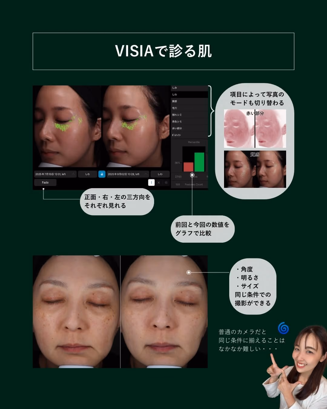 VISIA経過観察画面