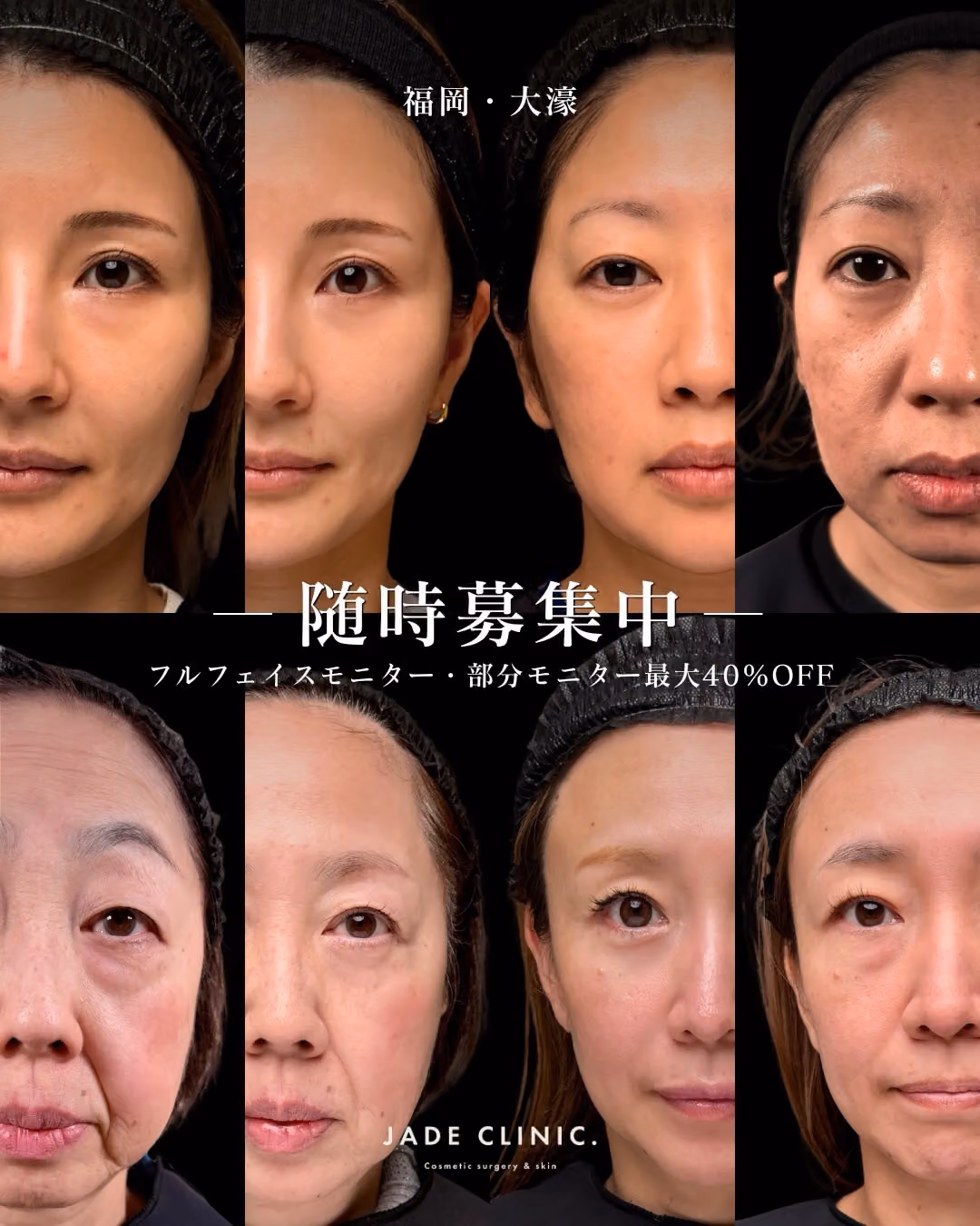 モニター募集｜JADE CLINIC. 気になっていた施術を身近に
