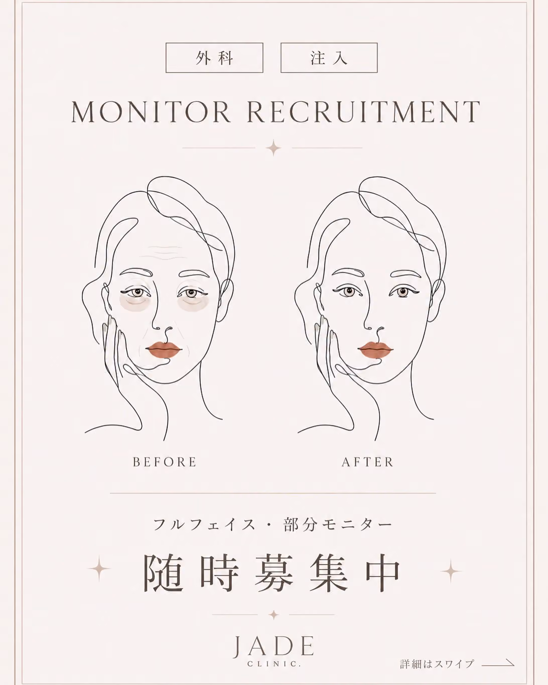 症例撮影協力で最大40%OFF