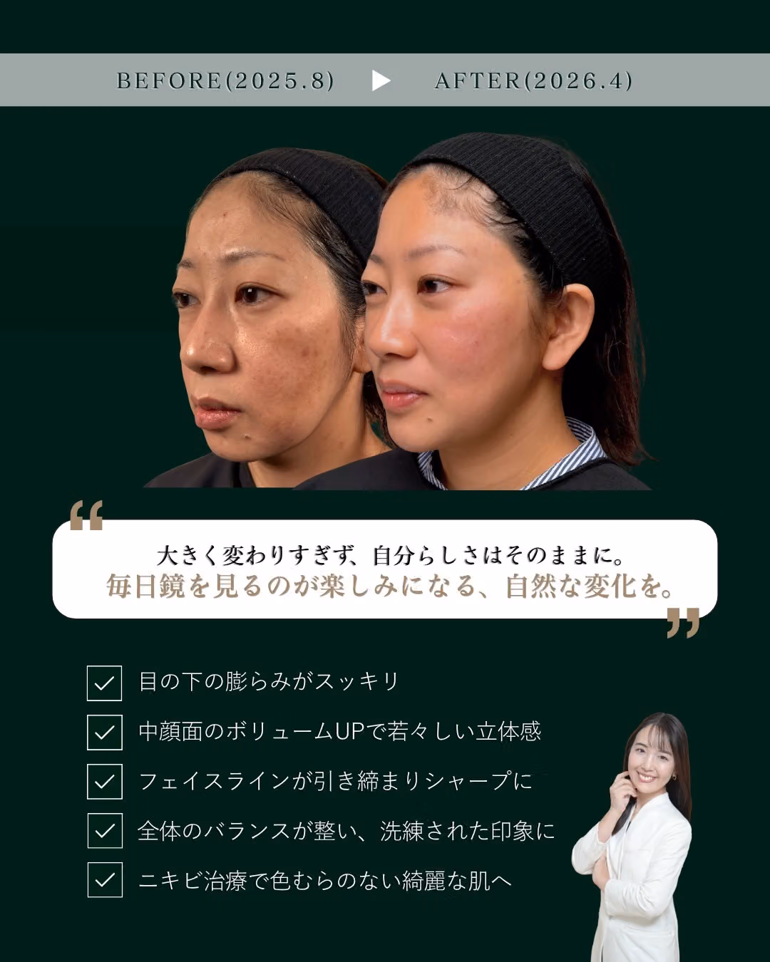 肌治療＋複合若返り1年｜症例5｜JADE CLINIC.